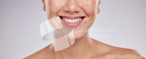 Image of Face smile, dental and teeth of woman in studio isolated on a gray background. Skincare makeup, cosmetics and lips, mouth and oral hygiene of happy female model with veneers, invisalign and wellness.