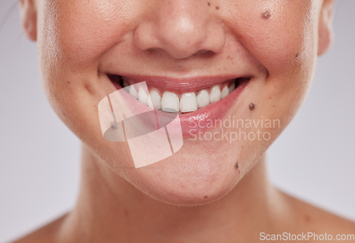 Image of Closeup, teeth and woman with dental care, cosmetics and treatment against grey studio background. Zoom, female and lady with whitening, mouth and oral care with smile, morning routine and grooming