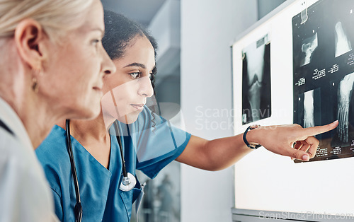 Image of Medical, x ray and surgery with doctors planning in meeting for leg scan, strategy or research. Medicine, consulting and radiology image with healthcare surgeons for diagnosis, treatment or operation