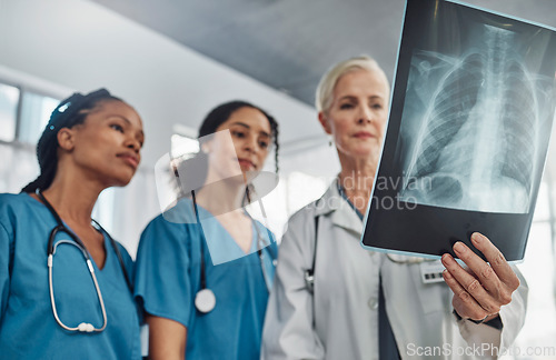 Image of Xray, doctor and nurses, team and medicine with analysis of lung scan and cardiology medical group. Surgeon, collaboration and results with healthcare, focus with health and prepare for surgery