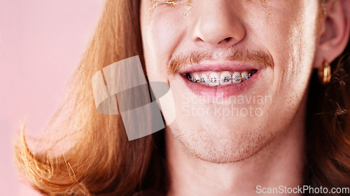 Image of Face, teeth and dental with man in braces, orthodontics and beauty with cosmetics and healthcare on pink background. Young, gen z and fashion, oral care and mouth zoom, smile and health insurance