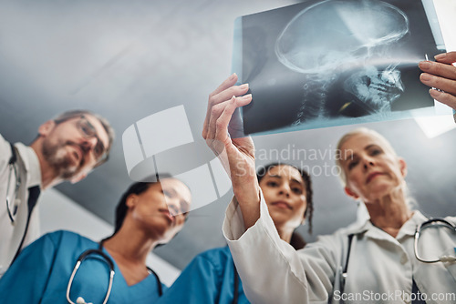 Image of Xray, doctors and nurses, team and healthcare, analysis of skull scan and neurology medical group. Surgeon, collaboration and results with health, head trauma with medicine and prepare for surgery