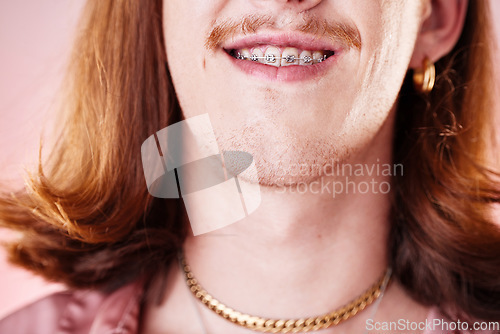 Image of Face, teeth and smile with man in braces, orthodontics and beauty with cosmetics and healthcare on pink background. Young, gen z and fashion, oral care and mouth zoom, dental and health insurance