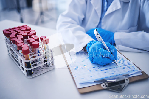 Image of Blood test, medicine documents and hands in laboratory for healthcare planning, science review or checklist. Scientist, report and writing medical results of dna investigation, paperwork and research