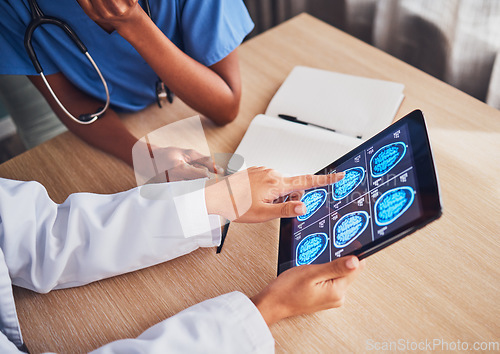 Image of Doctor, tablet and brain xray, neurology and digital test results, people and healthcare team in hospital. MRI, technology and screen in hands, cancer and radiology, anatomy and health assessment