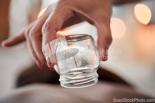 Image of Cupping therapy, glass vacuum cup in hand and woman at spa, therapist with deep tissue massage and wellness. Closeup, treatment at luxury resort with cosmetic, body care and health with acupuncture