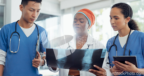 Image of Doctor, x ray and collaboration with a woman surgeon and team talking about diagnosis in a hospital. Medical, teamwork and healthcare with a female medicine professional training interns in a clinic