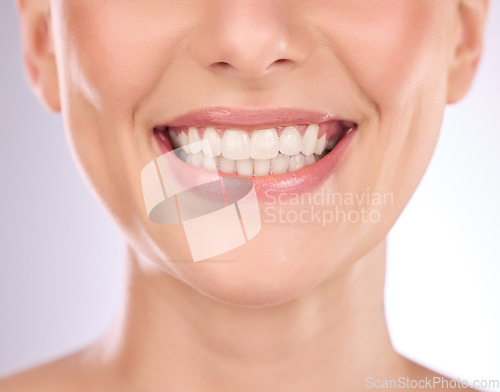 Image of Teeth, dental and oral hygiene with a model woman in studio on a gray background for tooth whitening. Dentist, healthcare and veneers with a female indoor to show a happy smile at a mouth specialist