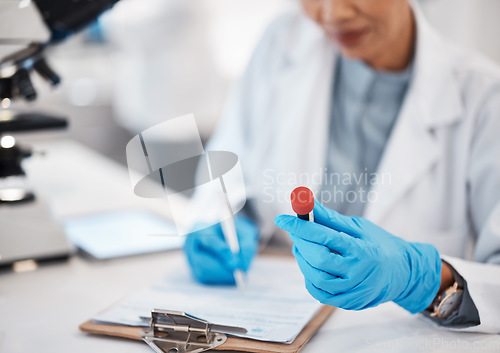 Image of Scientist, woman and writing lab results with study, focus or analysis for pharma development. Science expert, checklist and documents with microscope, innovation and report of pharmaceutical trial