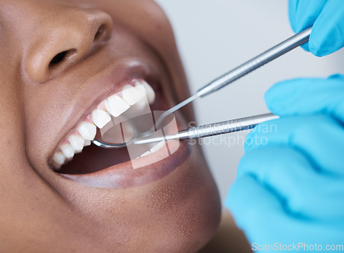 Image of Checkup, mouth and woman at the dentist for dental care, healthcare and search for cavities. Mirror, healthy and doctor looking at the teeth of a patient for treatment, oral hygiene and surgery