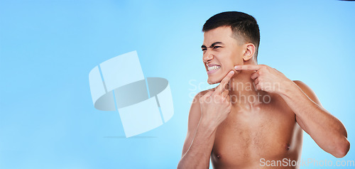 Image of Face, man and hands press pimple for acne or skin, mockup space and dermatology problem for skincare in studio on blue background. Self care, person scratch and pop blackhead for facial cleaning