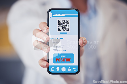 Image of Hand, healthcare and qr code on a phone screen for positive diagnosis of the monkeypox virus. Medical, app and test results on a mobile display in a clinic or pharmacy for feedback on a disease