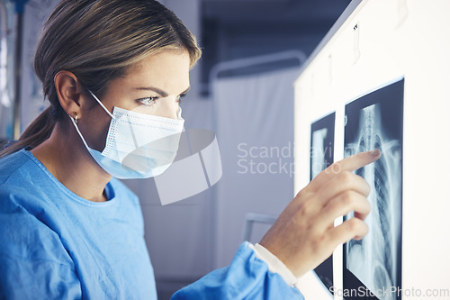 Image of Healthcare, woman and doctor analyzing xray for medical diagnosis on a screen in the hospital. Professional, career and female radiologist checking a spine, lung and chest scan in a medicare clinic.