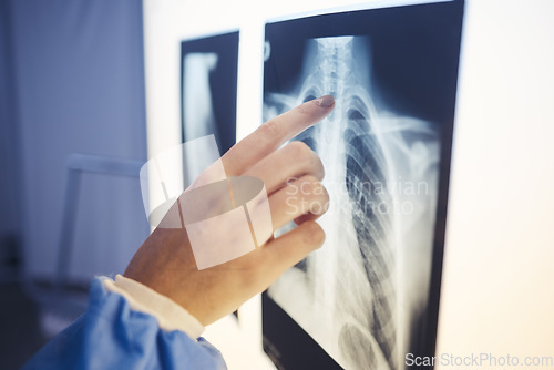 Image of Medical, hand and doctor analyzing xray for healthcare diagnosis on a screen in hospital. Professional, career and closeup of woman radiologist checking spine, lung and chest scan in medicare clinic.