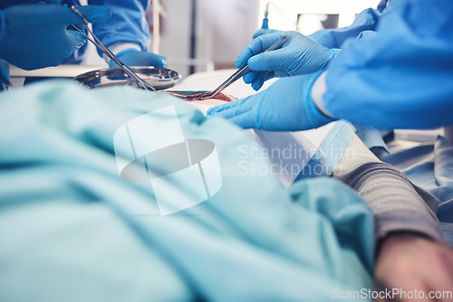 Image of Surgery, group hands and patient operation, hospital emergency service or doctors teamwork on wound healing. Accident operating room, medical tools and closeup surgeon collaboration on saving client