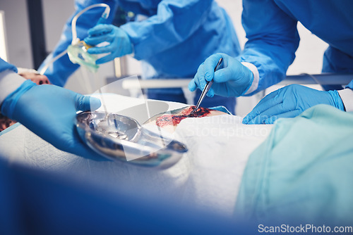 Image of Medical tools, group hands and surgery operation, hospital service or doctors healing wound, injury or patient anatomy. Health risk problem, ICU and closeup surgeon teamwork in operating room theatre