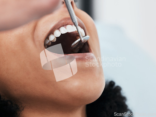 Image of Mouth, teeth of woman and dentist with tools for dental cosmetics, healthcare assessment and test in clinic. Oral service, orthodontics and closeup of patient, mirror and excavator for tooth cleaning