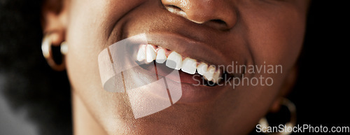 Image of Dental, beauty and teeth with closeup of person for medical, cosmetics and oral hygiene. Health, orthodontics and smile with mouth of black woman for self care, gum and whitening treatment on banner