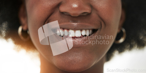 Image of Dental, smile and teeth with closeup of person for medical, cosmetics and oral hygiene. Healthcare, orthodontics and beauty with mouth of black woman for self care, gum and whitening treatment