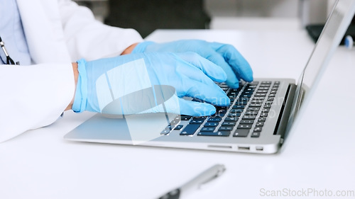 Image of Hands of a scientist in surgical gloves, typing on a laptop in a medical lab. Closeup of a healthcare professional studying, making discovery and innovative breakthrough through DNA and RNA research