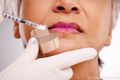 Image of Mouth needle, plastic surgery hands and woman with closeup surgeon augmentation, lip filler or silicone treatment. Studio spa clinic, collagen injection and client transformation on white background