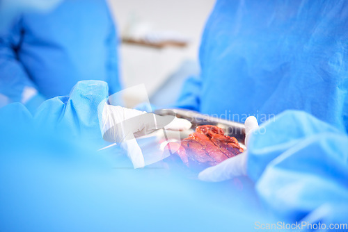 Image of Organ transplant, hands and doctor surgery, medical support or teamwork on liver, healing accident injury or anatomy. Emergency, lung blood and closeup surgeon collaboration in ICU healthcare service