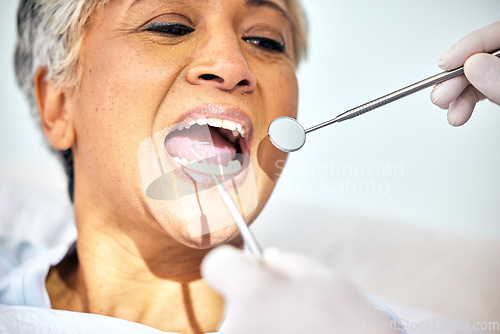 Image of Senior woman, mouth and dentist check teeth, metal tools and hands with healthcare, toothache and dental surgery. Cleaning, wellness and health with oral care procedure, equipment and help with trust