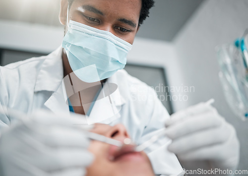 Image of Dentist, consulting and man with patient for medical service, teeth whitening and cleaning. Dental care, oral hygiene and closeup of person with equipment for consultation, check up and treatment