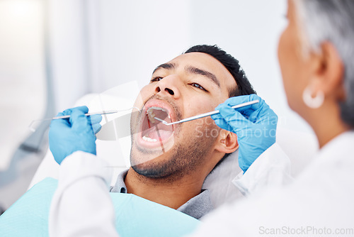 Image of Dentist, patient man and consultation for mouth and teeth whitening, cleaning or veneers hygiene. Oral health, orthodontics and a person for tooth care, dental assessment and mirror tools at clinic