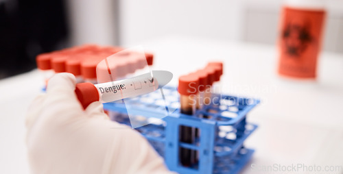 Image of Blood, dengue or hands of scientist in lab with virus and science for innovation, dna and rna research. Zoom, analysis closeup or person working with liquid for chemistry, test or breakthrough cure