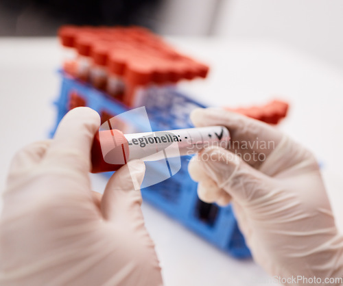 Image of Legionella, blood or hands of scientist with vaccine in science laboratory with dna and rna research. Test results, analysis closeup or person working with liquid for chemistry or breakthrough cure