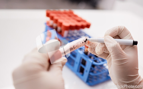 Image of Label, scientist or hands writing on blood test tube, DNA or science experiment in laboratory. Closeup, hepatitis or person with study sample or research for biology innovation or medical results