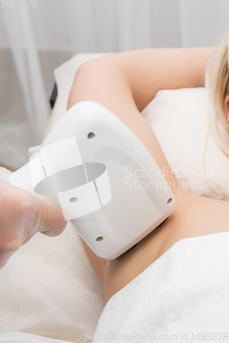 Image of Laser epilation of armpits