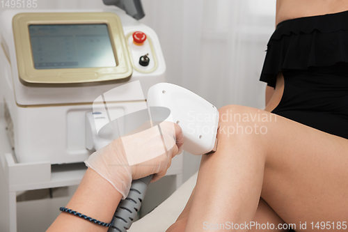 Image of Laser epilation of legs