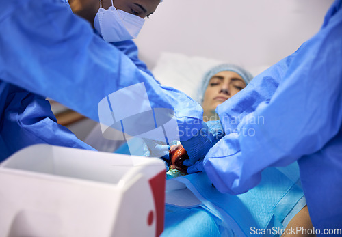 Image of Heart, transplant and doctors team doing surgery or emergency operation for treatment or healing anatomy in hospital. Rescue, medical and professional surgeon or healthcare teamwork collaboration