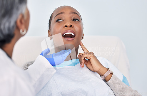 Image of Dentist, patient and women at clinic, toothache with consultation and check mouth for dental and medical treatment. Oral hygiene, healthcare and orthodontics, tooth decay with cleaning for cavity