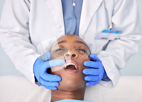 Image of Dentist check teeth, patient and people at clinic, consultation and mouth with dental health and medical treatment. Oral hygiene, healthcare and surgery, orthodontics and tooth decay with hands