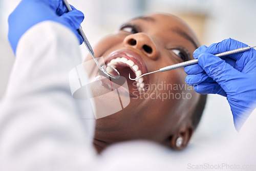 Image of Dentist, patient and women in consultation, tools and check mouth for dental health and medical treatment. Oral hygiene, healthcare and orthodontics, tooth decay and clean for cavity and excavator