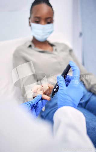 Image of Hospital, diabetes pen and woman with doctor for glucose test, sugar level and high blood pressure. Healthcare, monitor and patient with health worker for hypertension, wellness and consultation