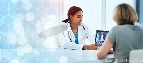 Image of Doctor, patient and pointing on tablet for diagnosis on banner for mock up, bokeh and overlay for healthcare. Space, medicine or technology for results on x-ray for treatment, clinic or hospital