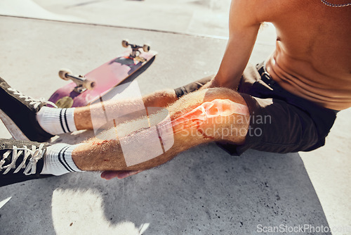 Image of Skateboard injury, pain and legs of man after fitness, exercise or sports workout in skatepark. Medical emergency, training accident problem and athlete skater anatomy of broken knee bone with blood