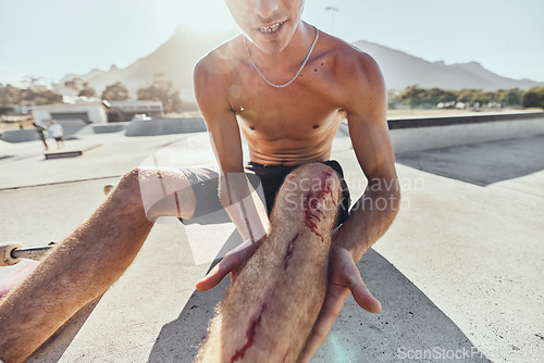 Image of Skater, knee pain and man with blood on injury after a skateboard accident in sports skate park in summer. First aid, emergency and person with leg wound or bruise for falling in training or exercise