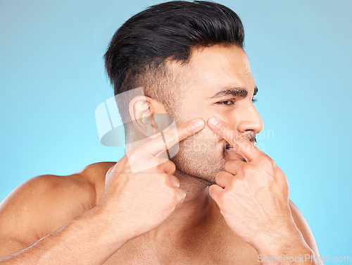 Image of Man, hands and pop acne of face for skincare, beauty wellness or skin dermatology. Indian man, upset and press facial pimples or blackhead in blue background studio for morning cosmetics care