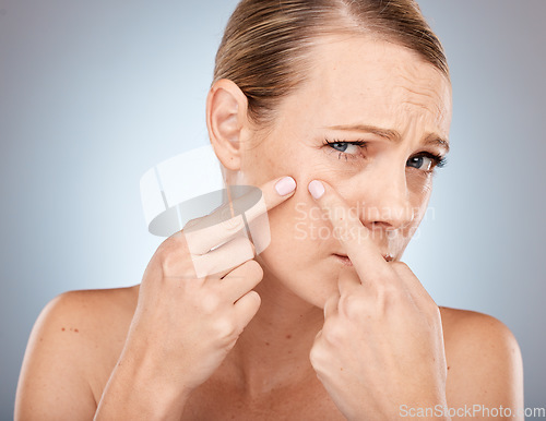 Image of Face, skincare and woman squeeze acne, pimple or blackhead in studio on a gray background. Wellness, dermatology and cosmetology portrait of sad female model from Canada worried about skin health.