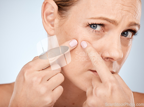 Image of Health, skincare and woman squeeze acne in face with studio background. Skin care, morning facial and lady with flaws, blemish and imperfection pop pimple or blackhead with fingers and hands.