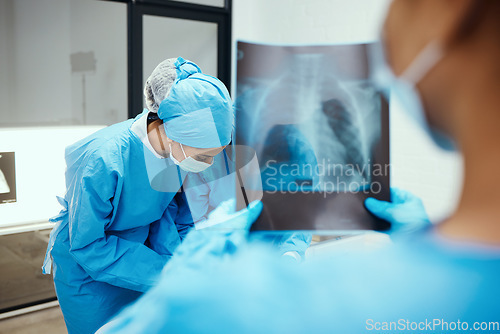 Image of Xray, body and surgery team in hospital, consulting for cancer tumor healthcare wellness or emergency risk. Nurse, doctor and medical worker for consultation, anatomy research and patient injury