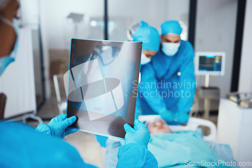 Image of Team of doctors, x ray and surgery in hospital with patient in stretcher. Teamwork, healthcare and medical professional with mammogram, nurses and surgeons preparing for operation of person in clinic