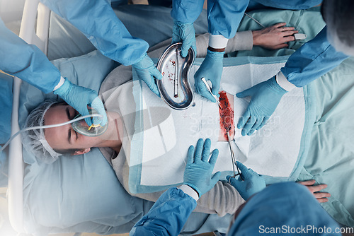 Image of Doctors, surgery and collaboration with a medicine team in scrubs operating on a man patient in a hospital. Doctor, nurse and teamwork with a medical group in a clinic to perform an operation