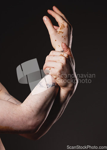 Image of Hand, vitiligo and man in studio for skincare, grooming and hygiene against black background with mockup. Hands, skin and guy model with melanin, pigmentation and product for body positivity mock up