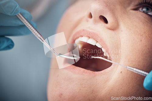 Image of Teeth, dental or woman at a dentist for surgery, teeth whitening or mouth cleaning for gum disease bacteria. Wellness, tooth decay or hands helping or working with oral tools in healthcare clinic